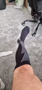 LegFit - Skarpety kompresyjne na żylaki i opuchnięte nogi photo review