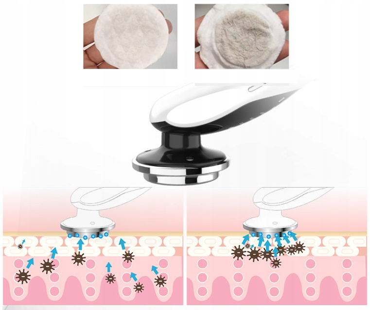 SkinLift EMS - MEZOTERAPIA BEZIGŁOWA MASAŻER EMS DO TWARZY - obrazek 6